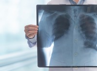 X 線:医学に革命をもたらした偶然の発見 