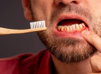 歯磨きをサボった結果:1週間後にはどうなる？ 