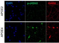 APOE2 遺伝子とアルツハイマー病のリスク:防御メカニズムに関する新たな洞察 